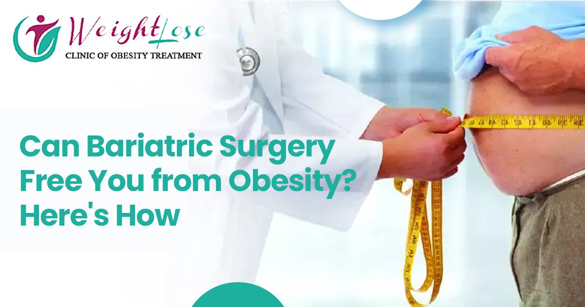Can Bariatric Surgery Free You from Obesity